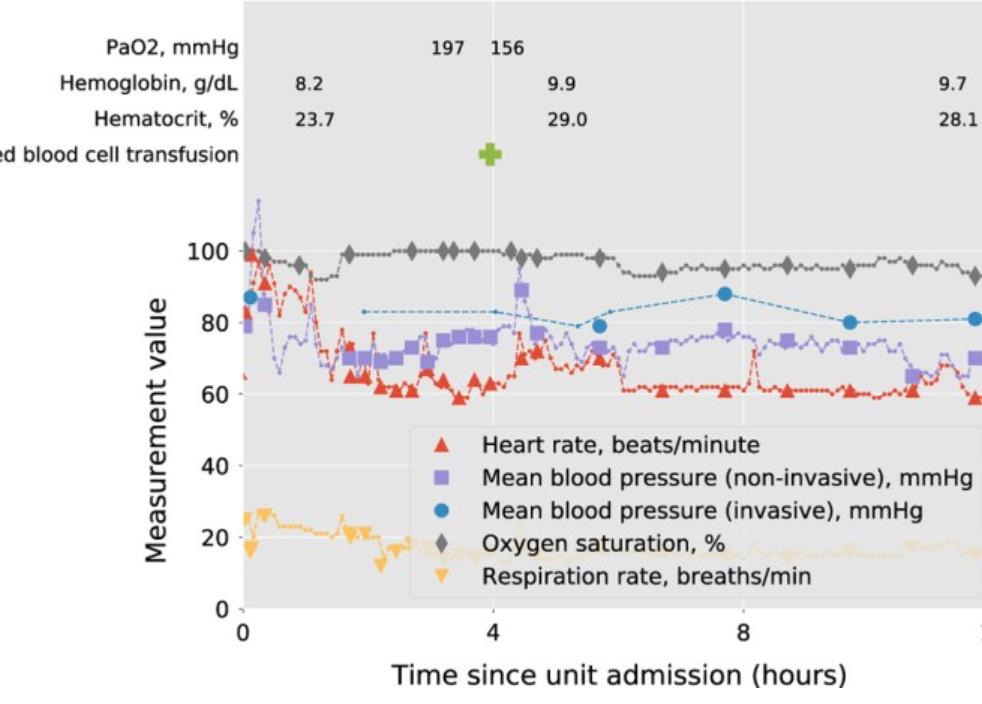 eICU   5.1GB电子病历